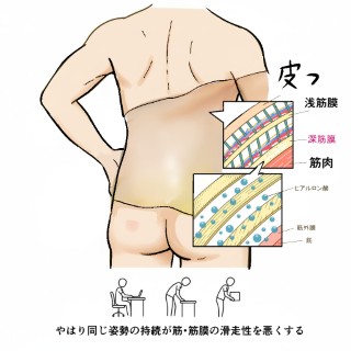 人の背面の模式図（骨格・筋肉層）